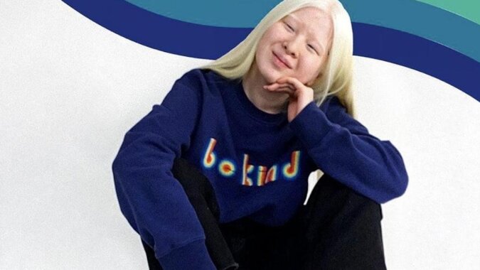 Dziewczynka albinos, która urodziła się w Chinach, została porzucona przez rodziców